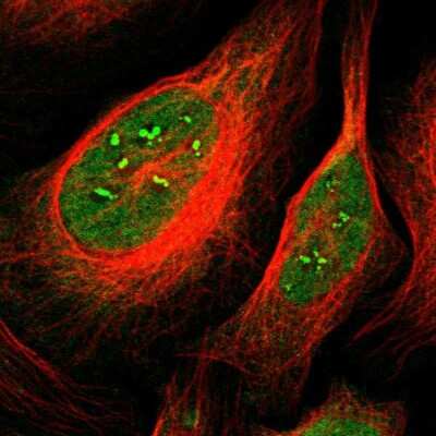 Immunocytochemistry/ Immunofluorescence: CaMKIV Antibody [NBP1-88210]