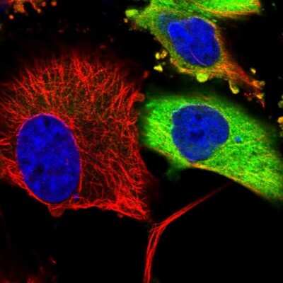 Immunocytochemistry/ Immunofluorescence: CaMKK alpha Antibody [NBP1-88208]
