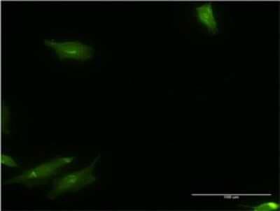 Immunocytochemistry/ Immunofluorescence: CaMKK alpha Antibody (4A11) [H00084254-M04]