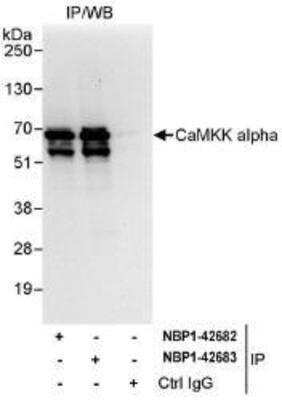 Immunoprecipitation: CaMKK alpha Antibody [NBP1-42682]