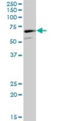 Western Blot: CaMKV Antibody [H00079012-B01P]