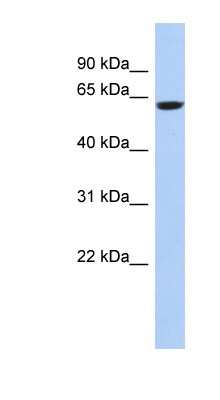 Western Blot: CaMKV Antibody [NBP1-56677]