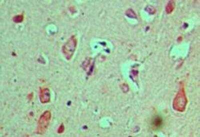 Immunohistochemistry-Paraffin: Cactin Antibody [NBP1-70775]