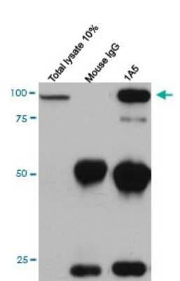 Western Blot: Cadherin-11 Antibody (1A5) [H00001009-M04]