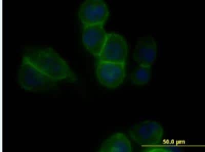 Immunocytochemistry/ Immunofluorescence: Cadherin-11 Antibody (3C8) [H00001009-M05-100ug]