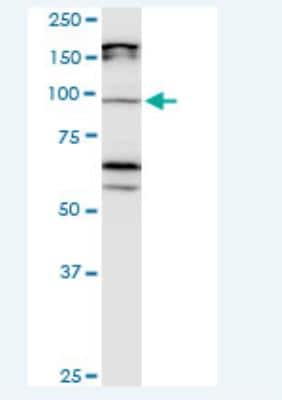 Western Blot: Cadherin-11 Antibody (3C8) [H00001009-M05-100ug]