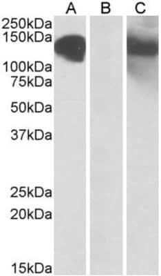 Western Blot: Cadherin-11 Antibody [NBP1-52045]