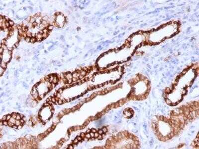 Immunohistochemistry-Paraffin: Cadherin-16 Antibody (CDH16/1071) - Azide and BSA Free [NBP2-47745]