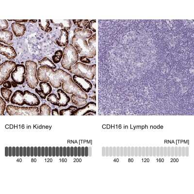 Immunohistochemistry-Paraffin: Cadherin-16 Antibody [NBP2-34028]