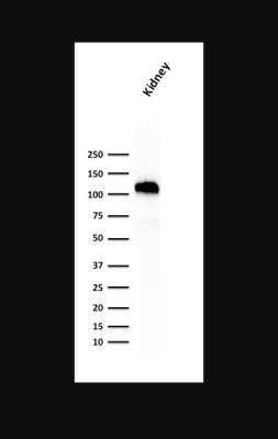 Western Blot: Cadherin-16 Antibody (SPM594) [NBP2-45158]