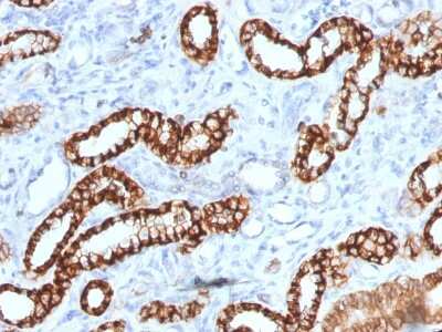 Immunohistochemistry-Paraffin: Cadherin-16 Antibody (rCDH16/1071) [NBP3-07139]