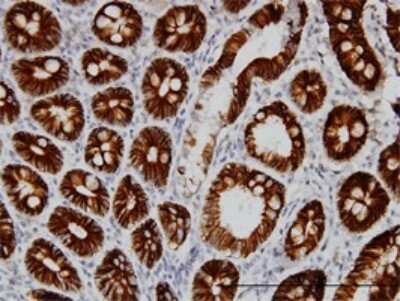 Immunohistochemistry-Paraffin: Cadherin-17 Antibody (1H3) [H00001015-M01]