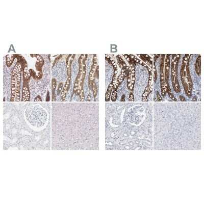 Immunohistochemistry-Paraffin: Cadherin-17 Antibody [NBP1-88239]