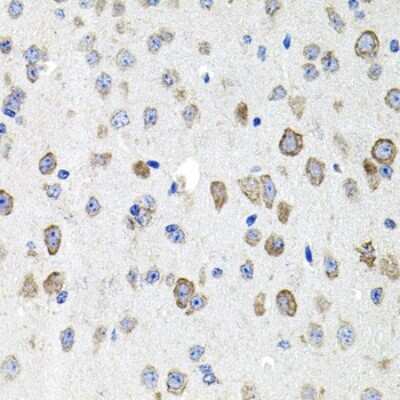 Immunohistochemistry-Paraffin: Cadherin-23 Antibody - Azide and BSA Free [NBP3-03833]