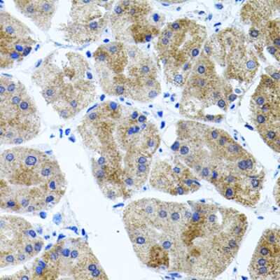 Immunohistochemistry-Paraffin: Cadherin-23 Antibody - Azide and BSA Free [NBP3-03833]