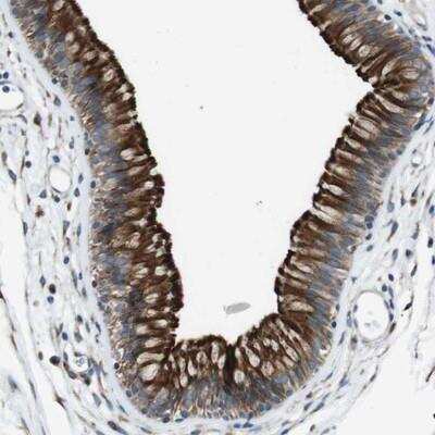 Immunohistochemistry-Paraffin: Cadherin-26 Antibody [NBP1-80623]