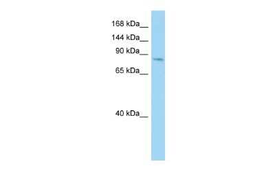 Western Blot: Cadherin-26 Antibody [NBP2-84582]