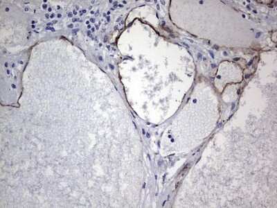 Immunohistochemistry: Cadherin-4/R-Cadherin Antibody (OTI4F5) [NBP2-46208]