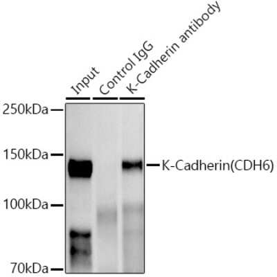 Immunoprecipitation: Cadherin-6/KCAD Antibody (5N2K3) [NBP3-16464]