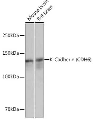 Western Blot: Cadherin-6/KCAD Antibody (5N2K3) [NBP3-16464]