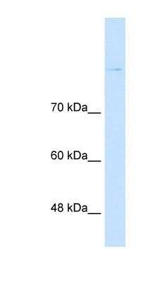 Western Blot: Cadherin-8 Antibody [NBP1-59221]