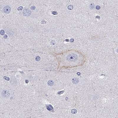 Immunohistochemistry-Paraffin: Cadherin-9 Antibody [NBP1-86498]