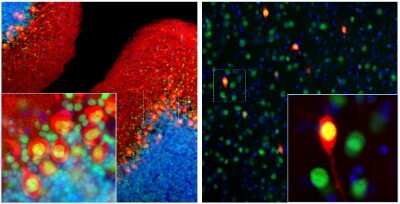 Immunocytochemistry/ Immunofluorescence: Calbindin D-28K Antibody (4H7) [NBP2-50048]