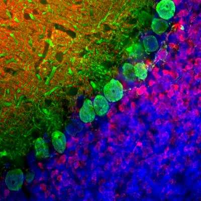 Immunohistochemistry Free-Floating: Calbindin D-28K Antibody (4H7) [NBP2-50048]