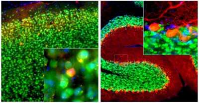 Immunocytochemistry/ Immunofluorescence: Calbindin D-28K Antibody (5A9) [NBP2-50050]
