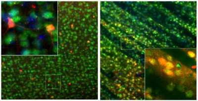 Immunocytochemistry/ Immunofluorescence: Calbindin D-28K Antibody [NBP2-50028]