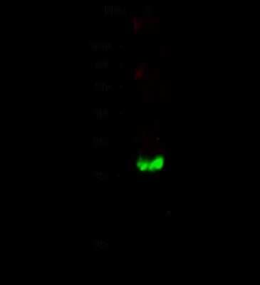 Western Blot: Calbindin D-28K Antibody [NBP2-99063]