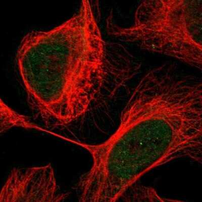 Immunocytochemistry/ Immunofluorescence: Calcineurin A Antibody [NBP1-88218]