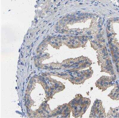 Immunohistochemistry-Paraffin: Calcineurin A Antibody [NBP1-88218]