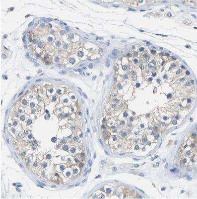 Immunohistochemistry-Paraffin: Calcineurin A Antibody [NBP1-88218]