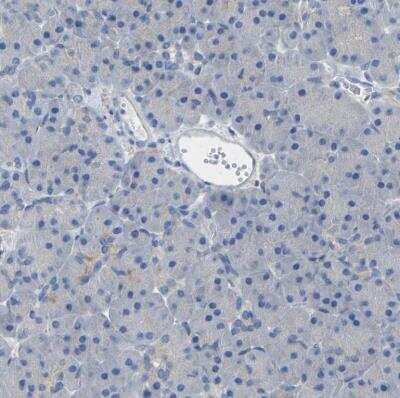 Immunohistochemistry-Paraffin: Calcineurin A Antibody [NBP1-88218]