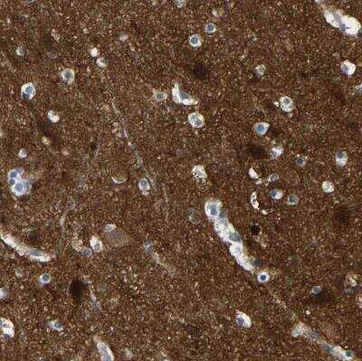 Immunohistochemistry-Paraffin: Calcineurin A Antibody [NBP1-88218]