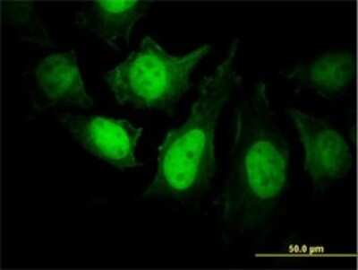 Immunocytochemistry/ Immunofluorescence: Calcineurin B Antibody (4E1) [H00005534-M01]