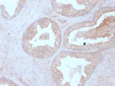 Immunohistochemistry-Paraffin: Calcineurin B Antibody (CALNB/2342) - Azide and BSA Free [NBP3-08464]