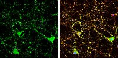 Immunocytochemistry/ Immunofluorescence: Calcineurin B Antibody [NBP2-15664]