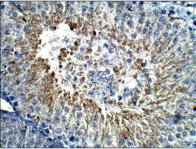 Immunohistochemistry-Paraffin: Calcitonin Antibody [NBP3-12261]