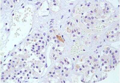Immunohistochemistry-Paraffin: Calcitonin Antibody (SP17) [NBP2-26483]