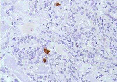 Immunohistochemistry-Paraffin: Calcitonin Antibody (SP17) [NBP2-26483]