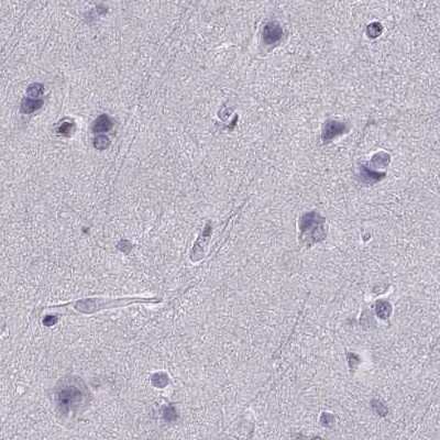Immunohistochemistry-Paraffin: Calcitonin R Antibody [NBP1-88041]