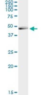 Immunoprecipitation: Calcium Activated Nucleotidase 1/CANT1 Antibody (1A1) [H00124583-M02]