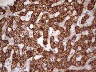 Immunohistochemistry: Calcium Activated Nucleotidase 1/CANT1 Antibody (OTI7F8) [NBP2-46056]