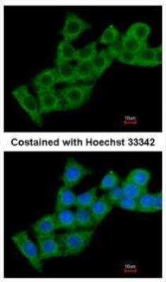 Immunocytochemistry/ Immunofluorescence: Calcium-binding-protein-P22 Antibody [NBP2-53090]