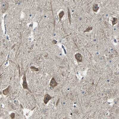 Immunohistochemistry-Paraffin: Calcium-binding-protein-P22 Antibody [NBP1-87589]
