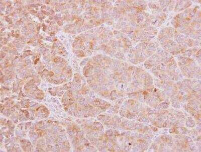Immunohistochemistry-Paraffin: Calcium-binding-protein-P22 Antibody [NBP2-53090]