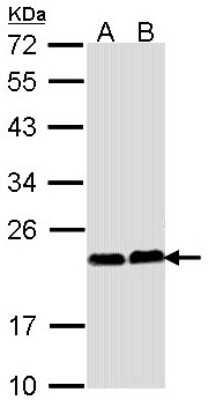 Western Blot: Calcium-binding-protein-P22 Antibody [NBP1-33736]