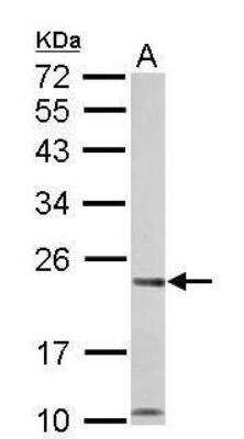 Western Blot: Calcium-binding-protein-P22 Antibody [NBP1-33736]